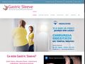 gastric-sleeve